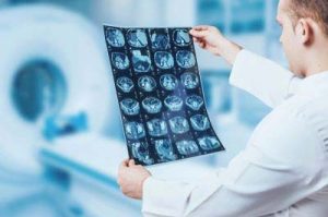 A doctor checks MRI scan