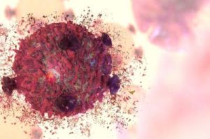 Imagens de células cancerígenas