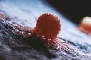 Illustrazione medica 3D di una cellula cancerosa