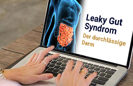 Frauenhände auf der Tastatur eines Laptops - auf dem Bildschirm ist eine Fachinformation zum Thema Leaky Gut Syndrom zu sehen