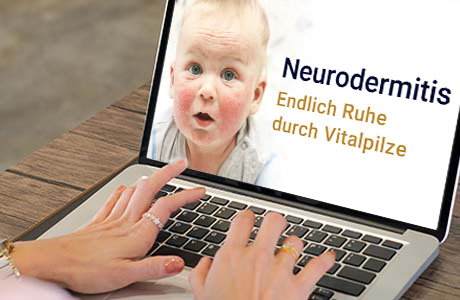 Frauenhände auf der Tastatur eines Laptops - auf dem Bildschirm ist eine Fachinformation zum Thema Neurodermitis zu sehen
