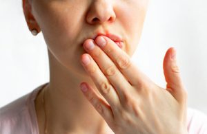 Primer plano de la mitad inferior del rostro de una mujer joven con ampollas de herpes alrededor de la boca. Ella sostiene tímidamente su mano delante de ella