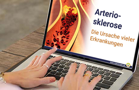 Frauenhände auf der Tastatur eines Laptops - auf dem Bildschirm ist eine Fachinformation zum Thema Arteriosklerose zu sehen