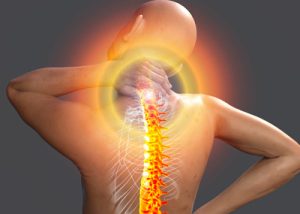 Illustration en 3D d'un torse humain dont la colonne vertébrale est représentée en jaune-orange de manière alarmante. Le personnage se saisit de la nuque, qui est le point focal des stimuli douloureux.