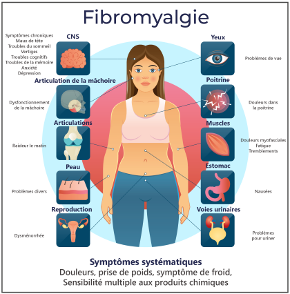 Grafische Darstellung möglicher Smptome einer Fibromyalgie