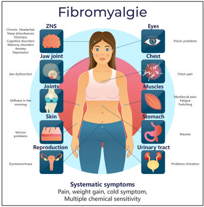 Graphical representation of possible symptoms of fibromyalgia