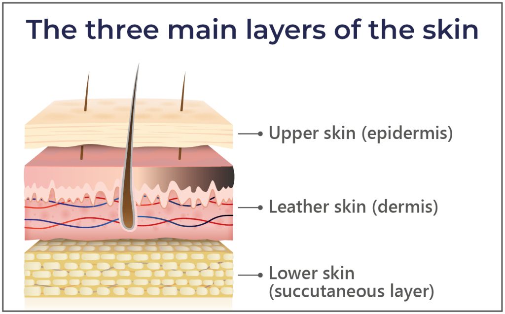 Graphic representation of the three main layers of the skin